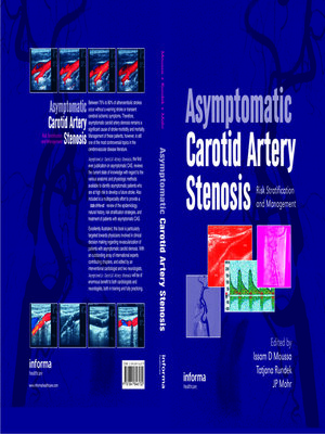 cover image of Asymptomatic Carotid Artery Stenosis